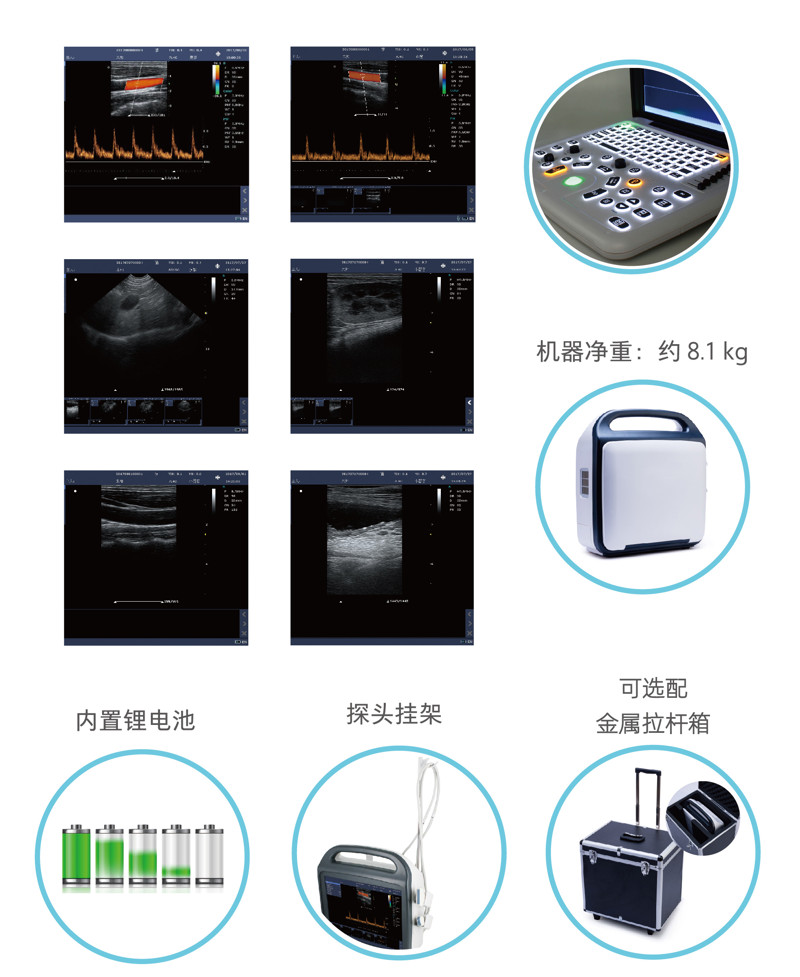 腹部彩超可以檢查出懷孕嗎